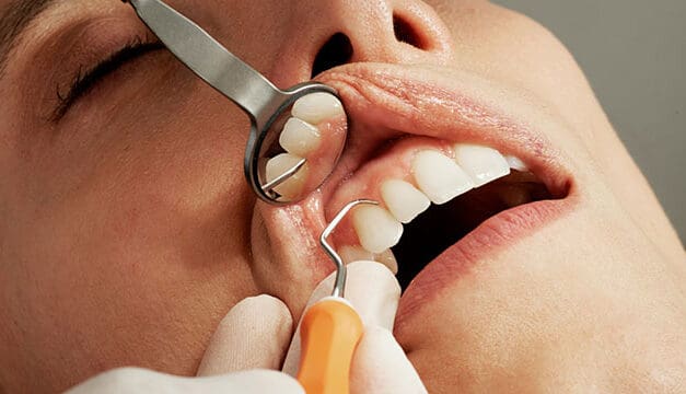 Liberal spin about Conservatives and dentists has no teeth