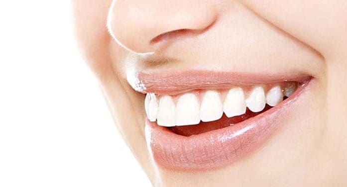 White teeth smile Orthodontics