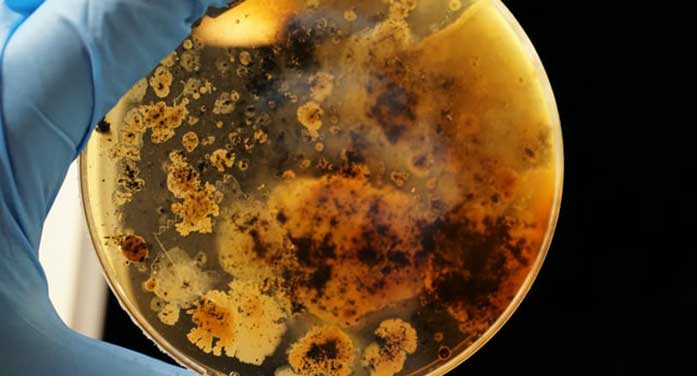 bacteria