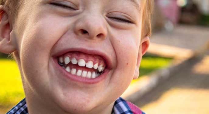 Common Dental Issues Children Face and How To Tackle Them