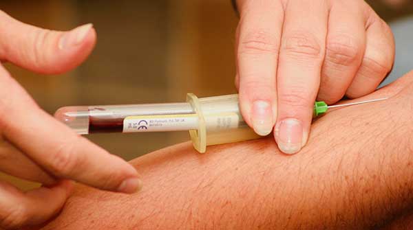 blood-test-needle • Troy Media scleroderma