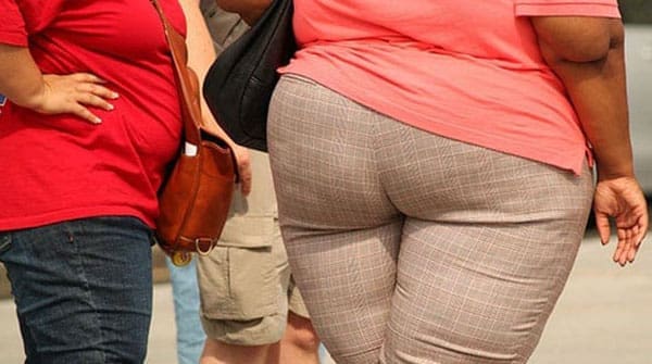 Feds need to take leadership role on rising obesity rates