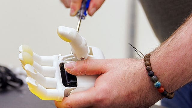 AI (artificial intelligence) revolutionizes prosthetic by creating adaptive partners that enhance user interactions