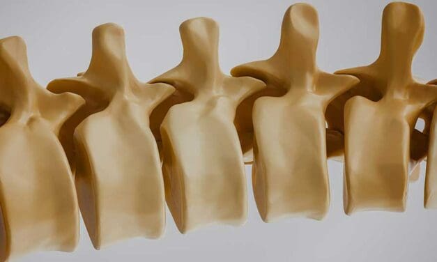 9 Spinal Cord Stimulator Complications Patients Report Most
